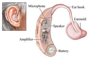 Hearing aid.jpg
